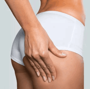 κυτταρίτιδα - EMS HIFEM Sculpting Pro IV