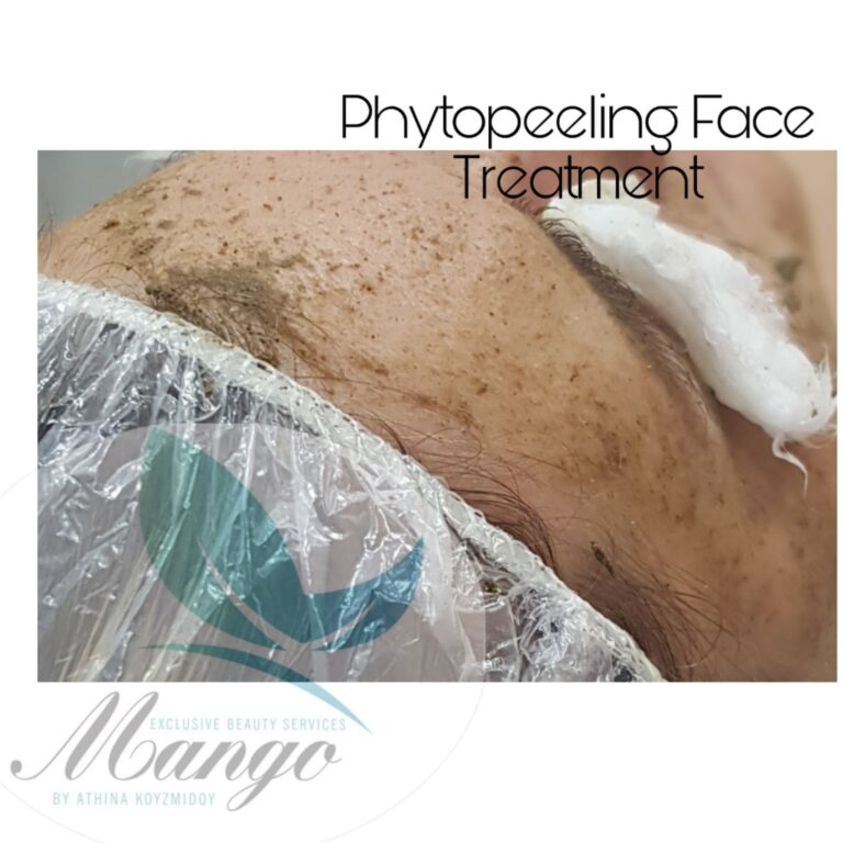 Phytopeeling 83699a41